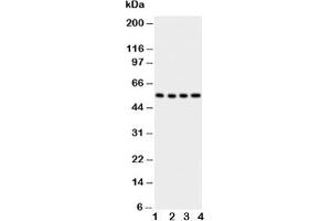 Western blot testing of Glut5 antbody;  Lane 1: U87;  2: 293T;  3: HT1080;  4: SW620 cell lysate (SLC2A5 antibody  (AA 481-501))