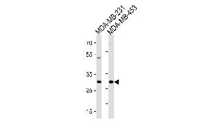 ASB11 Antibody (N-term) (ABIN1881072 and ABIN2843226) western blot analysis in MDA-MB-231,MDA-MB-453 cell line lysates (35 μg/lane). (ASB11 antibody  (N-Term))