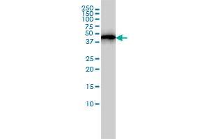 ACTR3 monoclonal antibody (M02), clone 2B6 Western Blot analysis of ACTR3 expression in A-431 . (ACTR3 antibody  (AA 1-418))