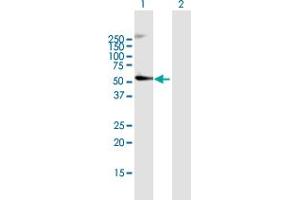 Western Blot analysis of CRBN expression in transfected 293T cell line by CRBN MaxPab polyclonal antibody. (CRBN antibody  (AA 1-442))