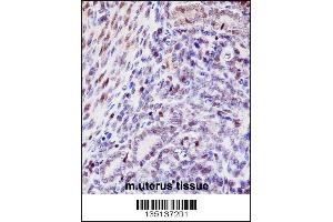 Mouse Hoxd10 Antibody immunohistochemistry analysis in formalin fixed and paraffin embedded mouse uterus tissue followed by peroxidase conjugation of the secondary antibody and DAB staining.