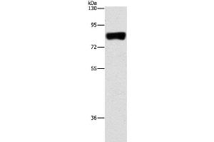 Western Blot analysis of Hela cell using ARHGAP25 Polyclonal Antibody at dilution of 1:500 (ARHGAP25 antibody)