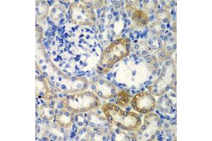Immunohistochemistry of paraffin-embedded rat kidney using DCTD antibody  at dilution of 1:200 (40x lens). (DCMP Deaminase (DCTD) (AA 1-178) antibody)