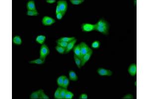Immunofluorescence staining of HepG2 cells with ABIN7168353 at 1:33, counter-stained with DAPI. (RBM45 antibody  (AA 170-244))