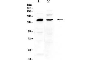Western blot analysis of NEDD4 using anti-NEDD4 antibody . (NEDD4 antibody  (AA 960-1245))