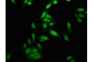 Immunofluorescence staining of Hela cells with ABIN7150342 at 1:166, counter-stained with DAPI. (Topoisomerase I antibody  (AA 358-501))