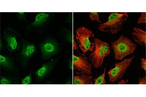 ICC/IF Image O-GlcNAc transferase antibody detects O-GlcNAc transferase protein at nucleus by immunofluorescent analysis. (OGT antibody)