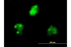 Immunofluorescence of monoclonal antibody to KHDRBS1 on A-431 cell. (KHDRBS1 antibody  (AA 176-275))