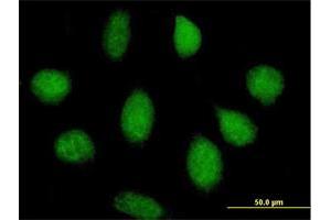 Immunofluorescence of purified MaxPab antibody to KIAA0157 on HeLa cell. (FAM175B antibody  (AA 1-311))