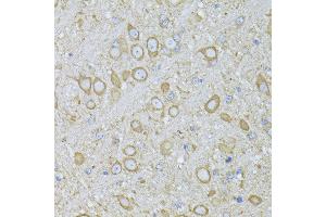 Immunohistochemistry of paraffin-embedded Mouse brain using MTNR1A antibody (ABIN6128254, ABIN6144165, ABIN6144166 and ABIN6216865) at dilution of 1:100 (40x lens). (Melatonin Receptor 1A antibody  (AA 281-350))