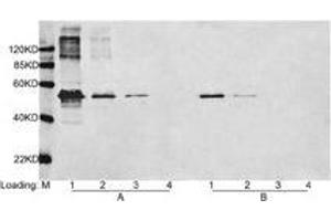 Loading: Lane 1-3 Multiple Tag (Purified) (ABIN1536315, 400 ng, 80 ng,16 ng) Lane 4. (DYKDDDDK Tag antibody)