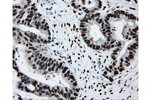 Image no. 1 for anti-Replication Protein A2, 32kDa (RPA2) antibody (ABIN1500733) (RPA2 antibody)