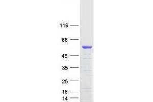 Validation with Western Blot (Dematin Protein (Transcript Variant 1) (Myc-DYKDDDDK Tag))