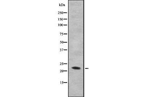 Western blot analysis IL28B using HuvEc whole cell lysates (IL28B antibody)