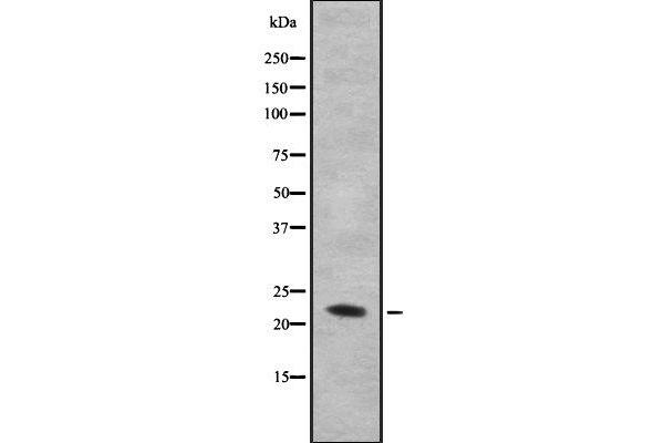 IL28B antibody