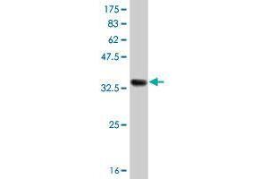 Western Blot detection against Immunogen (38. (SLC25A25 antibody  (AA 2-110))
