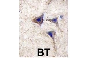 Formalin-fixed and paraffin-embedded human brain tissue reacted with BRAF Antibody , which was peroxidase-conjugated to the secondary antibody, followed by DAB staining. (SNRPE antibody  (AA 424-453))