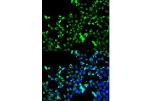 Immunofluorescence analysis of A549 cell using CALR antibody. (Calreticulin antibody)