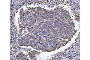 IHC analysis of ATP5F1B using anti-ATP5F1B antibody (ABIN7599866). (Atp5f1b (AA 123-529) antibody)