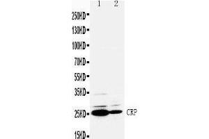 Anti-C Reactive Protein antibody, Western blotting Lane 1: SMMC Cell Lysate Lane 2:  Cell Lysate