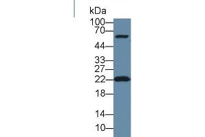 Western Blot; Sample: Human Hela cell lysate; Primary Ab: 1µg/ml Rabbit Anti-Human DTYMK Antibody Second Ab: 0.