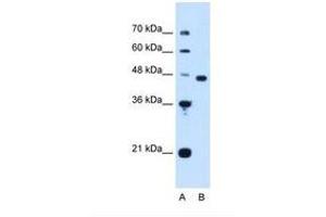Image no. 1 for anti-Proliferation-Associated 2G4, 38kDa (PA2G4) (AA 178-227) antibody (ABIN321304) (PA2G4 antibody  (AA 178-227))