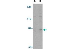 Western blot analysis of GPAM in rat brain tissue lysate with GPAM polyclonal antibody  at (A) 1 and (B) 2 ug/mL .