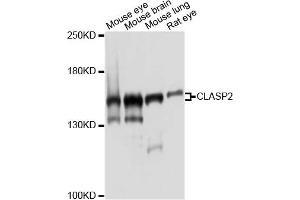 Western blot analysis of extracts of various cell lines, using CLASP2 antibody. (CLASP2 antibody)