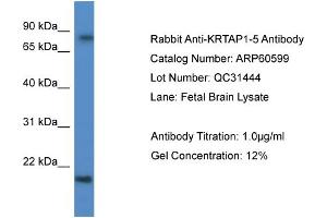 Western Blotting (WB) image for anti-Keratin Associated Protein 1-5 (KRTAP1-5) (C-Term) antibody (ABIN2788509) (KRTAP1-5 antibody  (C-Term))