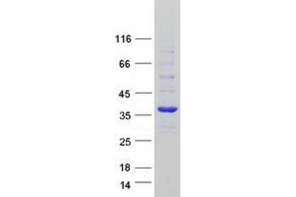 FAM84A Protein (Myc-DYKDDDDK Tag)