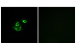 Immunofluorescence analysis of A549 cells, using CLCC1 antibody. (CLCC1 antibody  (Internal Region))