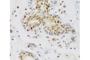 Immunohistochemistry of paraffin-embedded Human breast using NASP Polyclonal Antibody at dilution of 1:100 (40x lens).