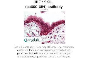 Image no. 1 for anti-SKI-Like Oncogene (SKIL) (AA 600-684) antibody (ABIN1739313) (SKIL antibody  (AA 600-684))