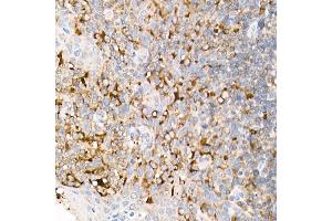 Immunohistochemistry (IHC) image for anti-Fas Ligand (TNF Superfamily, Member 6) (FASL) (AA 100-200) antibody (ABIN3020742)