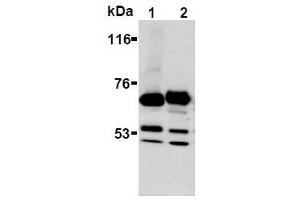 Western Blotting (WB) image for anti-Synaptotagmin I (SYT1) antibody (ABIN1109184) (SYT1 antibody)