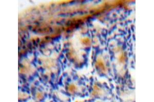 IHC-P analysis of Bowels tissue, with DAB staining. (VEGFC antibody  (AA 47-413))