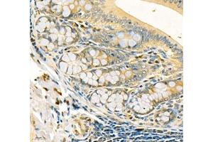 Immunohistochemistry of paraffin embedded rat colon using CDH19 (ABIN7073258) at dilution of 1:500 (400x lens)