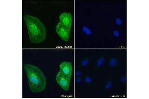 ABIN6391387 Immunofluorescence analysis of paraformaldehyde fixed U2OS cells, permeabilized with 0. (TIAM1 antibody  (C-Term))
