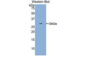 Western Blotting (WB) image for anti-Interleukin 2 Receptor, gamma (IL2RG) (AA 23-262) antibody (ABIN3206507)