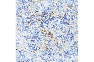 Immunohistochemistry of paraffin-embedded rat spleen using TP53I11 antibody (ABIN6131365, ABIN6149418, ABIN6149419 and ABIN6216636) at dilution of 1:100 (40x lens). (TP53I11 antibody  (AA 1-70))