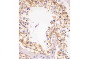 (ABIN6242519 and ABIN6577251) staining PDXK in human testis tissue sections by Immunohistochemistry (IHC-P - paraformaldehyde-fixed, paraffin-embedded sections). (PDXK antibody  (AA 1-312))
