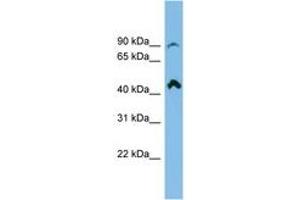 Image no. 1 for anti-NEDD4 Binding Protein 2-Like 2 (N4BP2L2) (AA 107-156) antibody (ABIN6745094) (N4BP2L2 antibody  (AA 107-156))