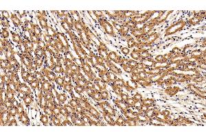Immunohistochemistry (IHC) image for anti-Leukemia Inhibitory Factor Receptor alpha (LIFR) (AA 641-790) antibody (ABIN7437698)