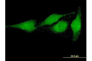 Immunofluorescence of purified MaxPab antibody to PRUNE on HeLa cell. (PRUNE antibody  (AA 1-453))