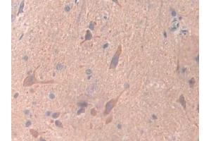 Detection of UBD in Rat Spinal cord Tissue using Polyclonal Antibody to Ubiquitin D (UBD)