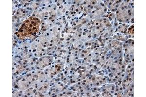 Immunohistochemical staining of paraffin-embedded Kidney tissue using anti-GBE1 mouse monoclonal antibody.