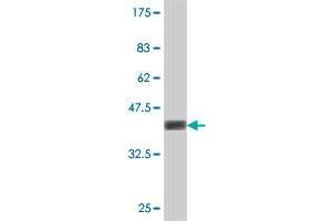 Western Blot detection against Immunogen (37 KDa) . (Stabilin 1 antibody  (AA 1804-1902))