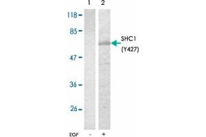 Western blot analysis of extracts from 293T cells using SHC1 (phospho Y427) polyclonal antibody . (SHC1 antibody  (pTyr427))