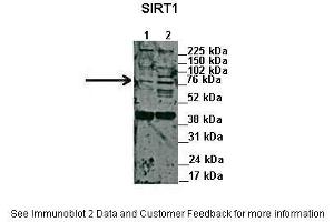 Lanes:   1. (SIRT1 antibody  (N-Term))