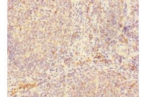 Immunohistochemistry of paraffin-embedded human tonsil tissue using ABIN7147132 at dilution of 1:100 (Integrin beta 2 antibody  (AA 24-220))